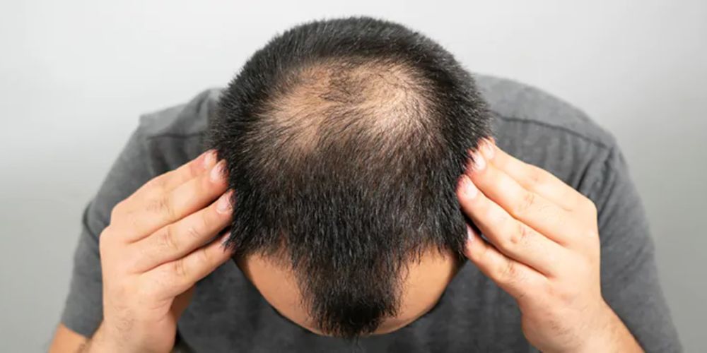 foto van dunner wordend haar bij mannen - de beste kapsels voor mannen met dunner wordend haar