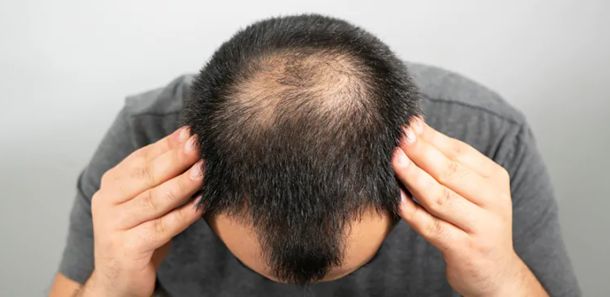 foto van dunner wordend haar bij mannen - de beste kapsels voor mannen met dunner wordend haar